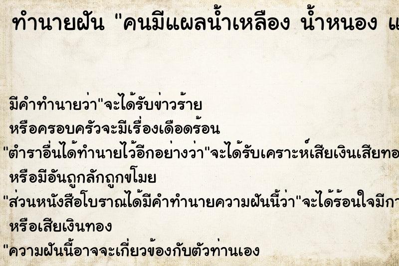 ทำนายฝัน คนมีแผลน้ำเหลือง น้ำหนอง แผลเต็มตัว